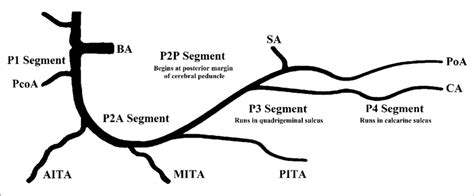 Posterior Cerebral Stroke - Avoiding Misdiagnosis In Patients With Posterior Circulation ...