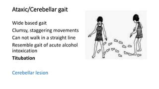 Gait abnormalities | PPT | Free Download