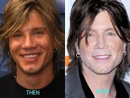 John Rzeznik Plastic Surgery Before And After Photos