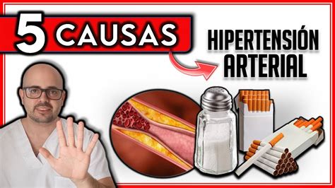 CAUSAS de PRESIÓN ARTERIAL ALTA || ¡Estas CAUSAS desarrollan HIPERTENSIÓN ARTERIAL! - YouTube