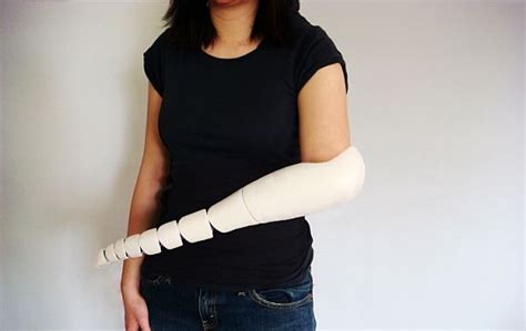 Prosthetic Arm adjusts to allow different grips for a variety of tasks ...