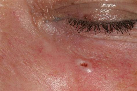 Skin Lesions | IntechOpen