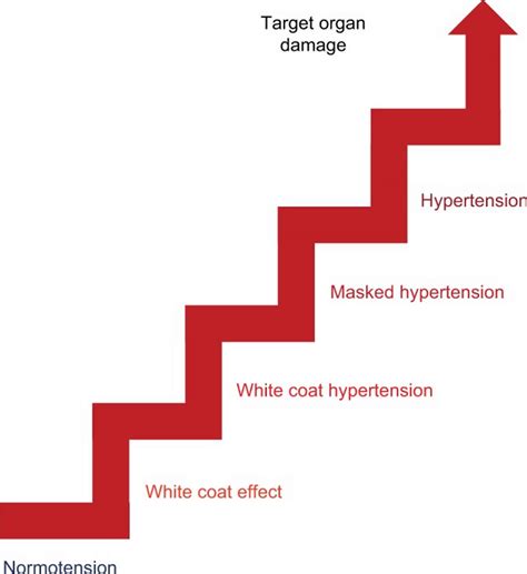 White coat syndrome, white coat syndrome blood pressure & treatment