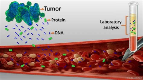 New ‘Liquid Biopsy’ Shows Early Promise in Detecting Cancer - 3 Quarks Daily