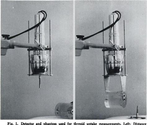 Figure 1 from A Comparison of Iodine-125 and Iodine-131 as Tracers in the Diagnosis of Thyroid ...