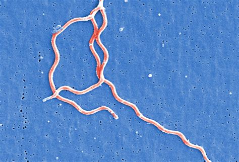 Free picture: micrograph, three, gram, negative, anaerobic, borrelia burgdorferi, bacteria