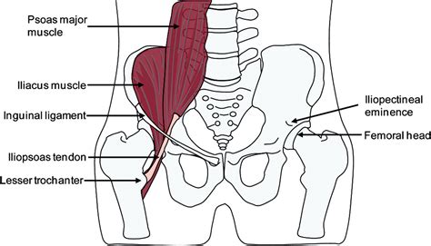 Iliopectineal Eminence Snapping Hip