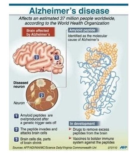 Infographic on Alzheimer's Disease - Gene Boosts Memory