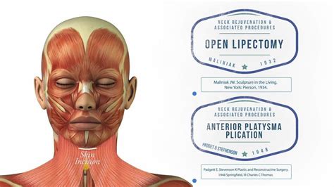 Neck Lift Treatment Options and Techniques - Video - RealSelf