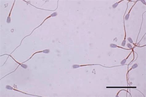 Sperm Microscope Slide