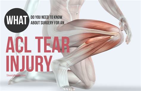 What Do You Need To Know About Surgery For An ACL Tear Injury ...