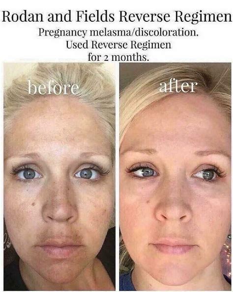 Pin on Rodan + Fields Skincare