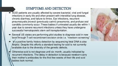 severe combined immunodeficiency syndrome