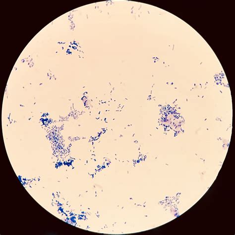 E. coli acid-fast stain | Escherichia coli acid-fast stain n… | Flickr