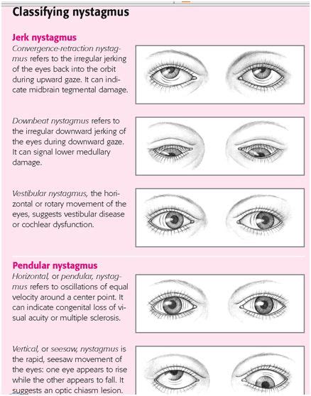 DUI Charges: DUI BLOG: Nystagmus: “The Eye Test”