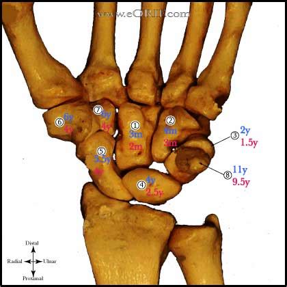 Wrist Anatomy Bones | eORIF