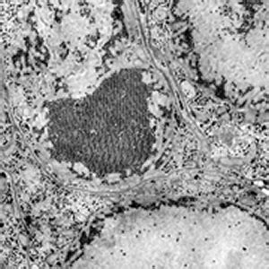 St. Louis encephalitis virus