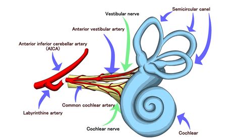 Vertigo caused by inner ear infection: Vertigo: Causes, Symptoms, and Treatment