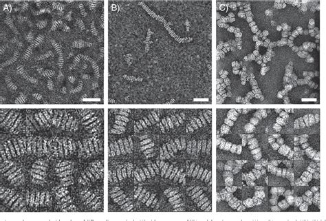 [PDF] Optimized negative-staining electron microscopy for lipoprotein studies. | Semantic Scholar