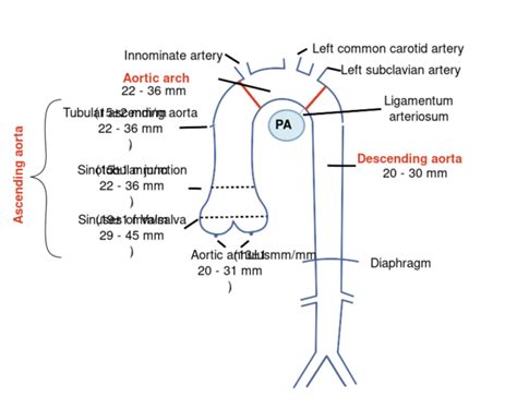 Aorta - Echopedia