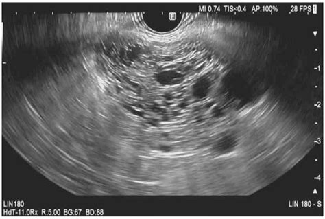 Diagnostics | Free Full-Text | Role of Endoscopic Ultrasound in the ...