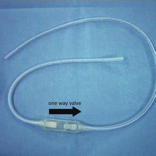 A pleuroperitoneal Denver® shunt catheter (arrows) positioned in the ...