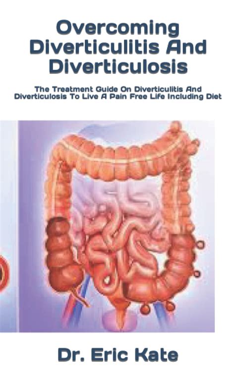 Buy Overcoming Diverticulitis And Diverticulosis: The Guide On ...