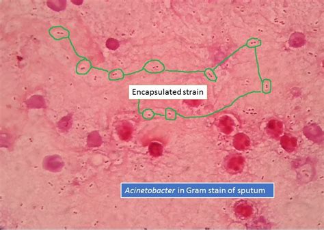 Acinetobacter: Introduction, Morphology, Pathogenecity, Lab Diagnosis