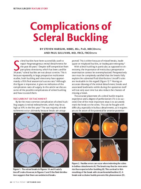 (PDF) Complications of Scleral Buckling