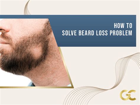 How to Solve Beard Loss Problem? - Gold City Best Hair Transplant Turkey