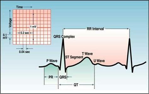 U wave | Ekg interpretation, Ecg interpretation, Nursing notes