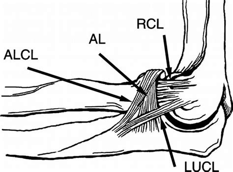 Lateral Ulnar Collateral Ligament Injury (PLRI) - Shoulder & Elbow - Orthobullets