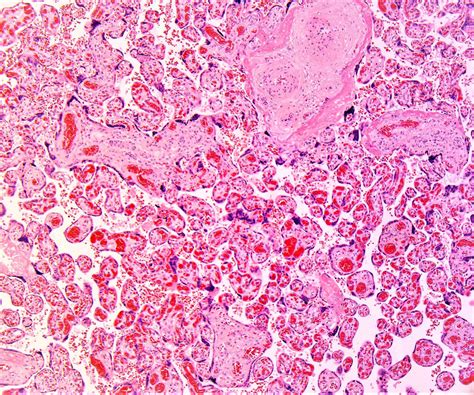 Placenta Histology