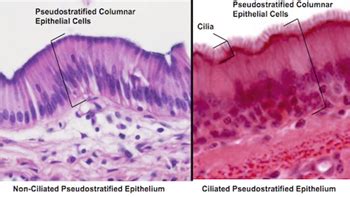 Pseudostratified Columnar Epithelium Location