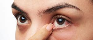 Laser Eye Surgery Risks and Side Effects | DLV Vision