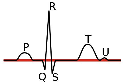 File:Linia izoelektryczna EKG.svg