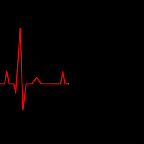 Irregular Heartbeat GIFs - Find & Share on GIPHY