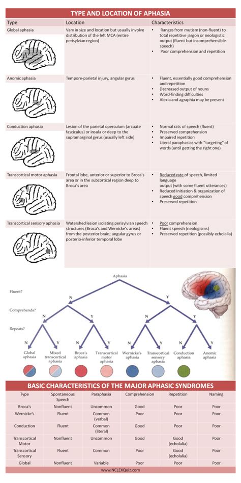 Type, Location & Basic Characteristics of Aphasia Cheat Sheet | Aphasia ...