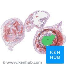 Amniotic sac: Anatomy, structure and function | Kenhub