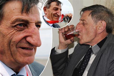 Man with world’s longest nose ‘at peace’ with super schnoz before death