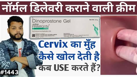 क्रीम जो नारमल डिलेवरी कराती है | Dinoprostone Gel Uses, Precautions & Side Effects | Primigyn ...