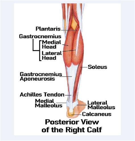 Figure 1 from Rupture of the medial head of the gastrocnemius muscle in late-career and former ...