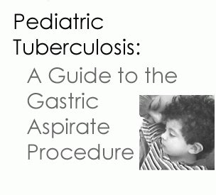 Pediatric Tuberculosis: A Guide to the Gastric Aspirate Procedure | Curry International ...