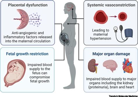 Pre-eclampsia: Challenges for Nanomedicine Development in Pregnancy ...