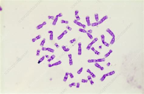 Metaphase Chromosomes (LM) - Stock Image - C022/2182 - Science Photo Library