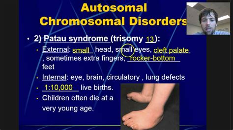 Chromosomal Disorders - YouTube