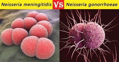 Neisseria meningitidis vs Neisseria gonorrhoeae- 32 Differences