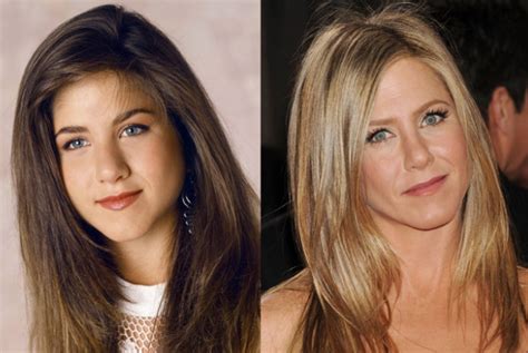 Jennifer Aniston Nose Job Surgery Before And After Photos | 2018 Plastic Surgery before and after