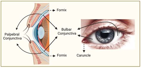 Genes | Free Full-Text | Genetic Aspects of Conjunctival Melanoma: A Review