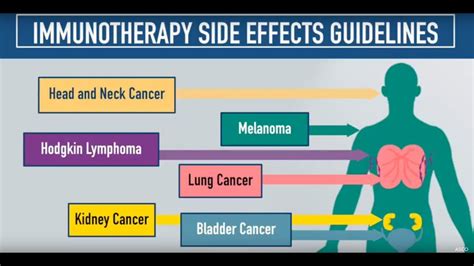 Immunotherapy Side Effects Guidelines - YouTube